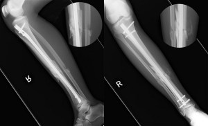 Pegleg: One Month Old